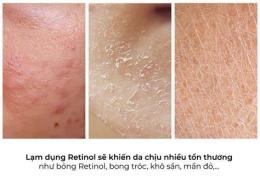 ảnh chụp màn hình bôi retinol bị bong da có sao không
