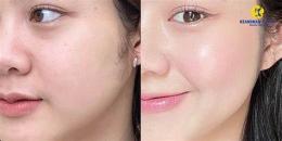 ảnh chụp màn hình cách làm da căng bóng tại nhà