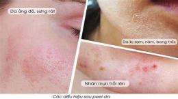 ảnh chụp màn hình chăm sóc da sau peel bong