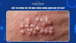 ảnh chụp màn hình đầu dương vật bị ngứa và bong da