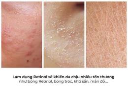 ảnh chụp màn hình dùng retinol bị bong da nên làm gì