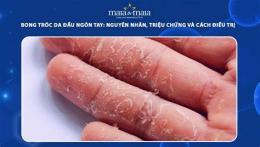 ảnh chụp màn hình ngón tay bong tróc da