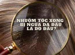 ảnh chụp màn hình nhuộm tóc xong bị bong da đầu