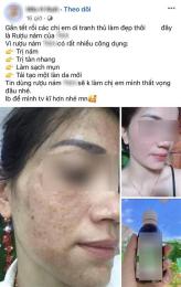 ảnh chụp màn hình thuốc bôi bong da tay