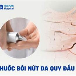 bao quy đầu bị khô bong da
