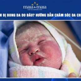 bé bị bong da tay