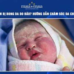 bé sơ sinh bị bong da có sao không
