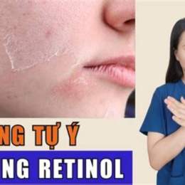 bôi retinol bị bong da có sao không