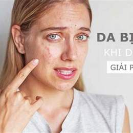 bôi retinol bị bong da