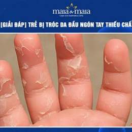 bong da ngón tay thiếu chất gì