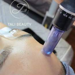 cấy collagen căng bóng da