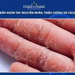 da bị bong tróc ở tay