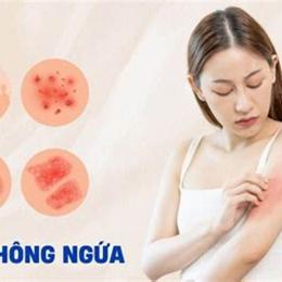 da bị đỏ ngứa bong tróc
