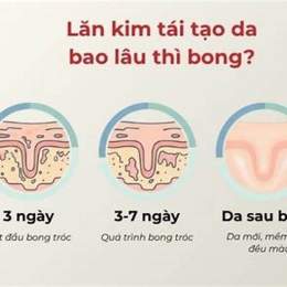 da bong sau lăn kim bị đỏ