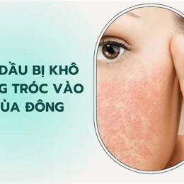 da dầu bị khô bong tróc vào mùa đông