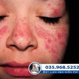 da mặt bị ngứa nổi đỏ và bong da