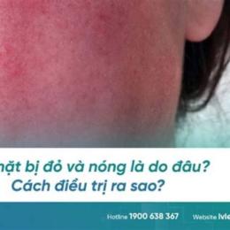 da mặt đau rát như bị bỏng