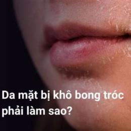 da mat kho bong troc phai lam the nao