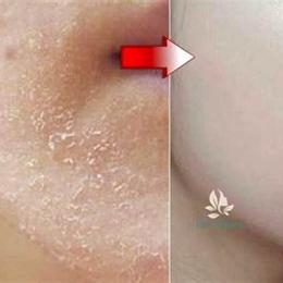 da nứt nẻ bong tróc