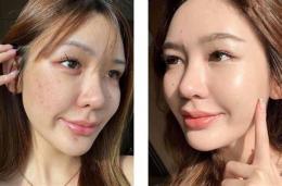 giao diện app ảnh da mặt căng bóng