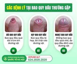 giao diện app bao quy đầu bị khô bong da