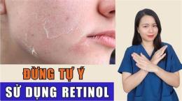giao diện app bôi retinol bị bong da có sao không