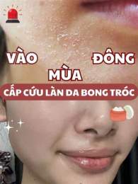 giao diện app da bong tróc mùa đông