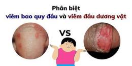 giao diện app đầu dương vật bị khô bong da