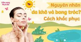 giao diện app mùa đông da mặt bị bong tróc