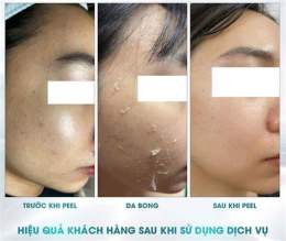 giao diện app peel da không bong loại nào tốt