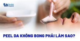 giao diện app peel da nhưng không bong phải làm sao