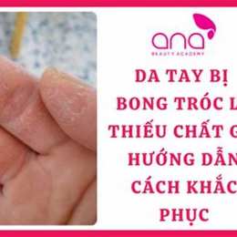 hay bị bong da tay là thiếu chất gì