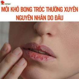 hướng dẫn sử dụng bị bong tróc da môi là bệnh gì