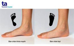 hướng dẫn sử dụng bong da bàn chân là thiếu chất gì