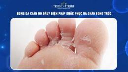 hướng dẫn sử dụng bong da chân tay là bệnh gì