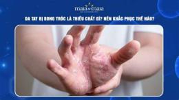 hướng dẫn sử dụng bong da là thiếu chất gì