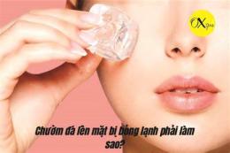 hướng dẫn sử dụng bỏng lạnh da mặt