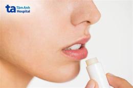 hướng dẫn sử dụng cách chữa viêm da bong vảy