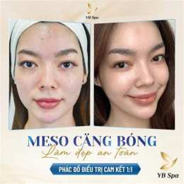 hướng dẫn sử dụng căng bóng da meso bio