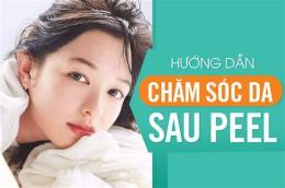 hướng dẫn sử dụng chăm sóc da sau peel không bong tróc