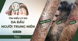 hướng dẫn sử dụng da đầu khô bong tróc ngứa