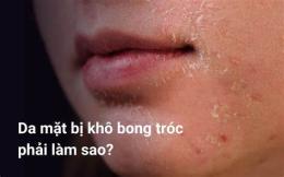 hướng dẫn sử dụng da mặt bị khô và bong tróc