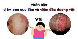 hướng dẫn sử dụng đầu dương vật bị bong da là bệnh gì