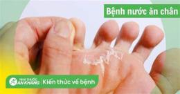 hướng dẫn sử dụng kẽ chân bị ngứa bong da