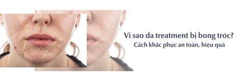 hướng dẫn sử dụng mặt bị bong tróc da