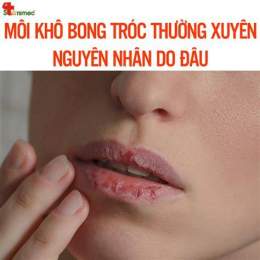 hướng dẫn sử dụng môi bị bong da liên tục