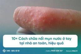 hướng dẫn sử dụng nổi bóng nước trên da là bệnh gì
