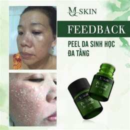 hướng dẫn sử dụng peel bong da mặt