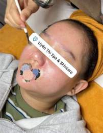 hướng dẫn sử dụng peel da bong trong mấy ngày