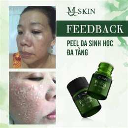 hướng dẫn sử dụng peel da k bong